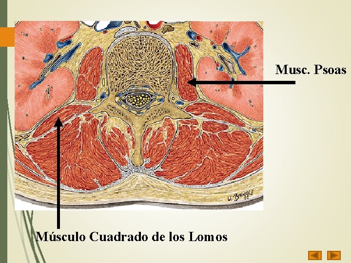 Musc. Psoas Músculo Cuadrado de los Lomos 