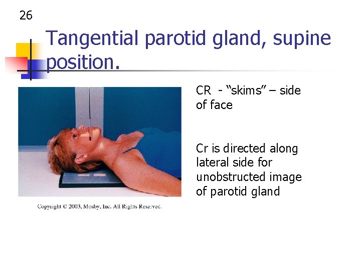 26 Tangential parotid gland, supine position. CR - “skims” – side of face Cr