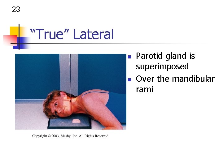 28 “True” Lateral n n Parotid gland is superimposed Over the mandibular rami 