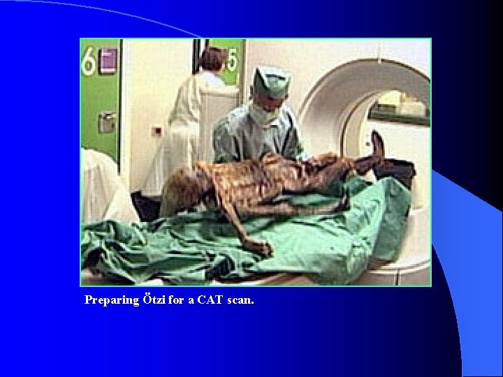 Preparing Ötzi for a CAT scan. Preparing Ötzi for a CAT scan.