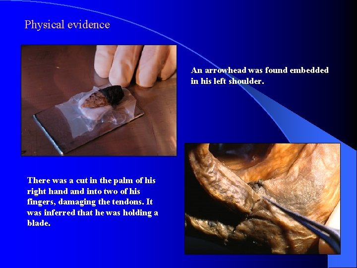 Physical evidence An arrowhead was found embedded in his left shoulder. There was a Physical evidence An arrowhead was found embedded in his left shoulder. There was a