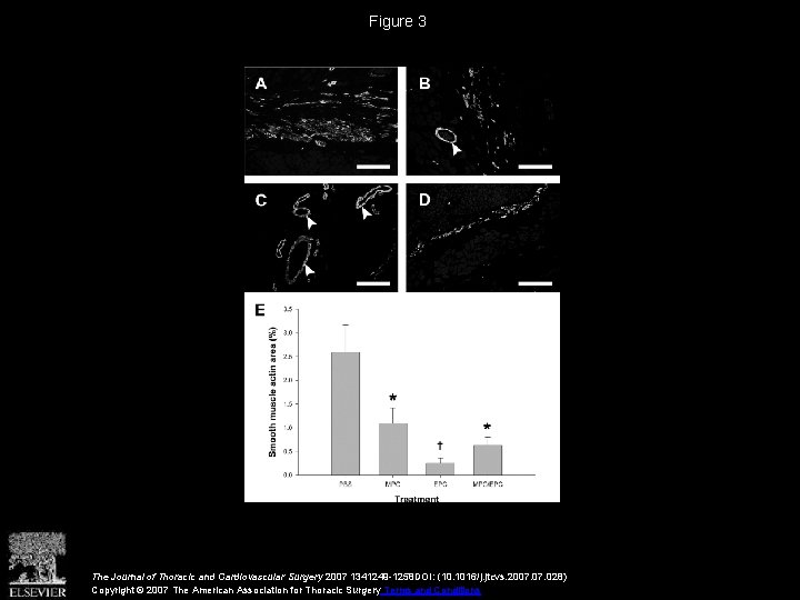 Figure 3 The Journal of Thoracic and Cardiovascular Surgery 2007 1341249 -1258 DOI: (10.