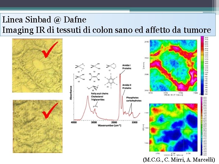 Linea Sinbad @ Dafne Imaging IR di tessuti di colon sano ed affetto da