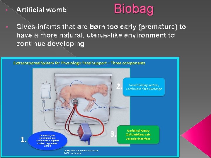Biobag • Artificial womb • Gives infants that are born too early (premature) to Biobag • Artificial womb • Gives infants that are born too early (premature) to