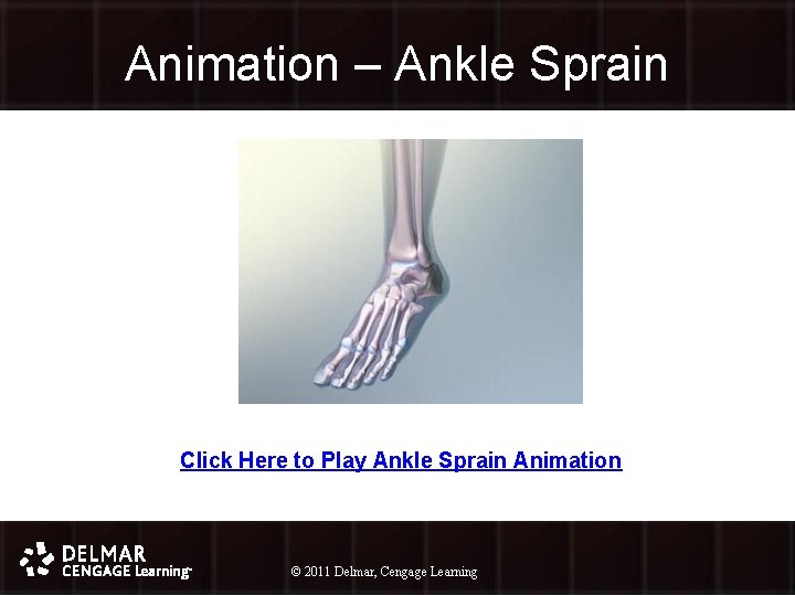 Animation – Ankle Sprain Click Here to Play Ankle Sprain Animation © 2011 Delmar,