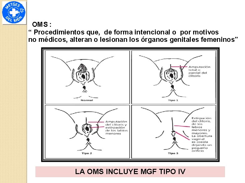 OMS : “ Procedimientos que, de forma intencional o por motivos no médicos, alteran