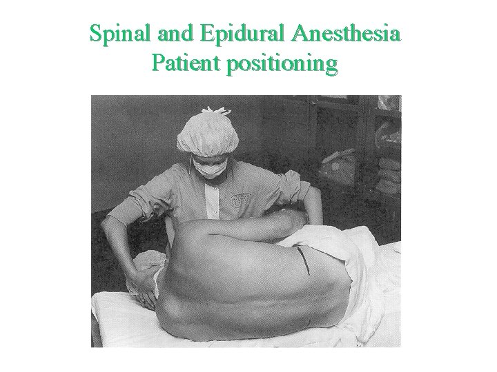 Spinal and Epidural Anesthesia Patient positioning 