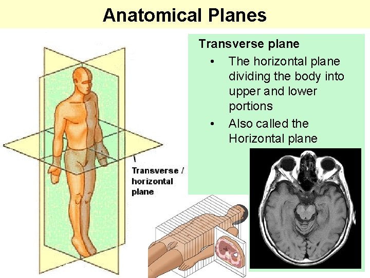 Anatomical Planes Transverse plane • The horizontal plane dividing the body into upper and