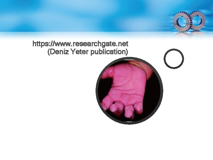 https: //www. researchgate. net (Deniz Yeter publication) 