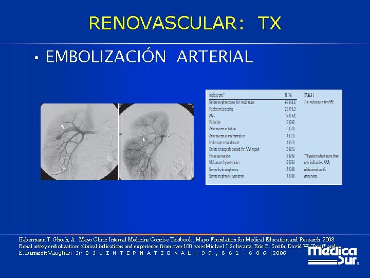 RENOVASCULAR: TX • EMBOLIZACIÓN ARTERIAL Habermann T. Ghosh, A. Mayo Clinic Internal Medicine Concise