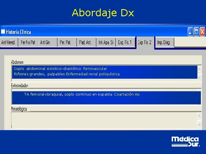 Abordaje Dx Soplo abdominal sistolico-diastólico: Renovascular Riñones grandes, palpables Enfermedad renal poliquística TA femoral<braquial,