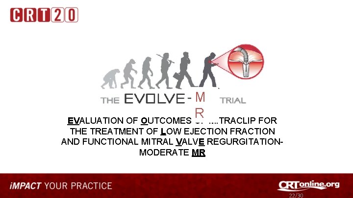 M R EVALUATION OF OUTCOMES OF MITRACLIP FOR THE TREATMENT OF LOW EJECTION FRACTION