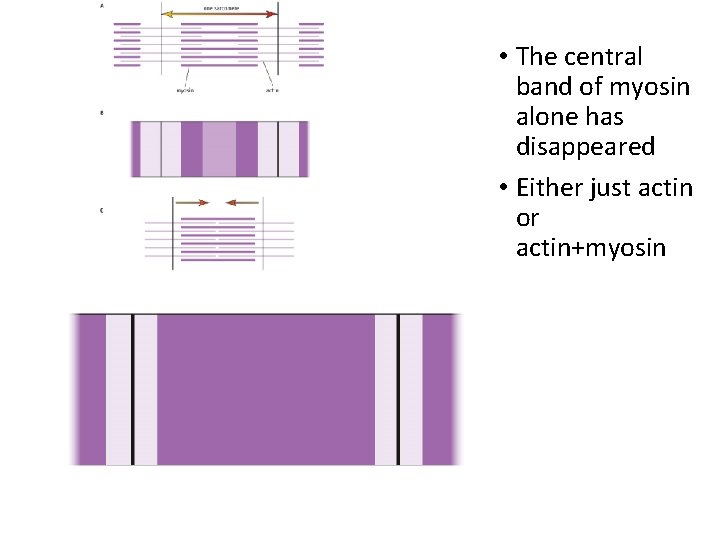  • The central band of myosin alone has disappeared • Either just actin