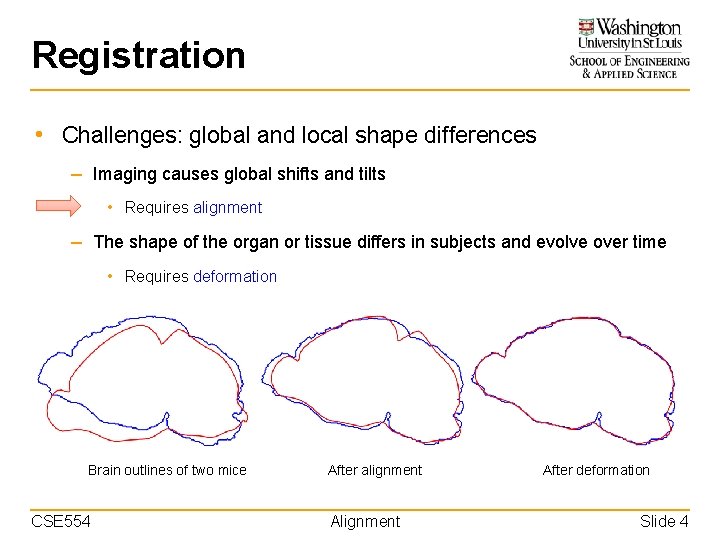 Registration • Challenges: global and local shape differences – Imaging causes global shifts and