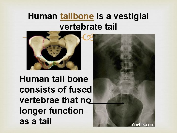 Human tailbone is a vestigial vertebrate tail Human tail bone consists of fused vertebrae