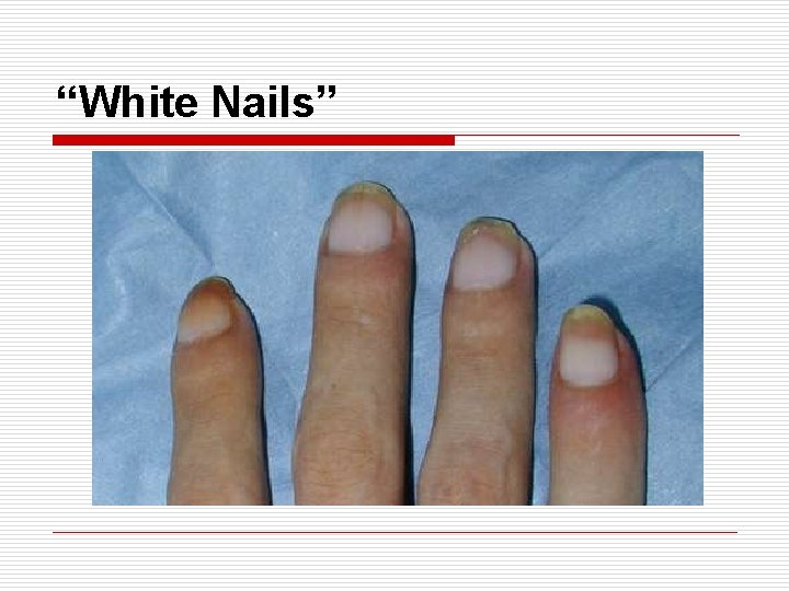 “White Nails” 