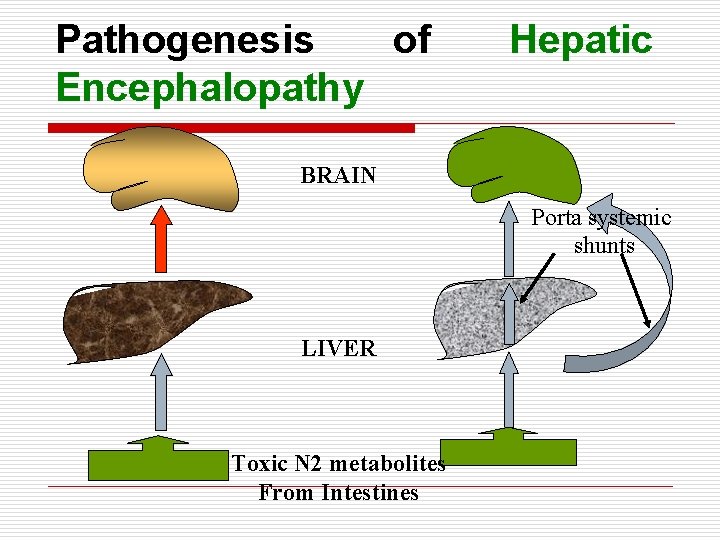 Pathogenesis of Encephalopathy Hepatic BRAIN Porta systemic shunts LIVER Toxic N 2 metabolites From