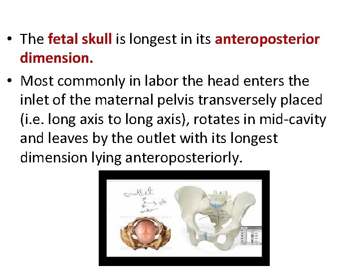  • The fetal skull is longest in its anteroposterior dimension. • Most commonly