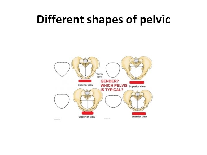 Different shapes of pelvic 