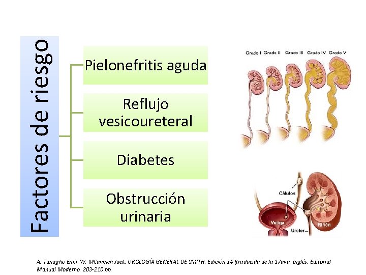 Factores de riesgo Pielonefritis aguda Reflujo vesicoureteral Diabetes Obstrucción urinaria A. Tanagho Emil. W.