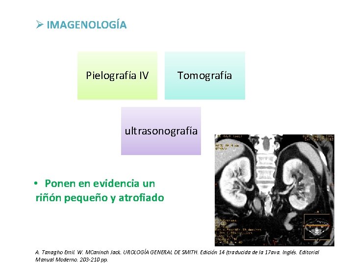 Ø IMAGENOLOGÍA Pielografía IV Tomografía ultrasonografía • Ponen en evidencia un riñón pequeño y