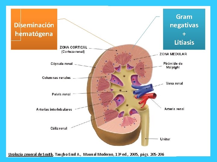 Diseminación hematógena Urología general de Smith, Tangho Emil A. , Manual Moderno, 13ª ed.