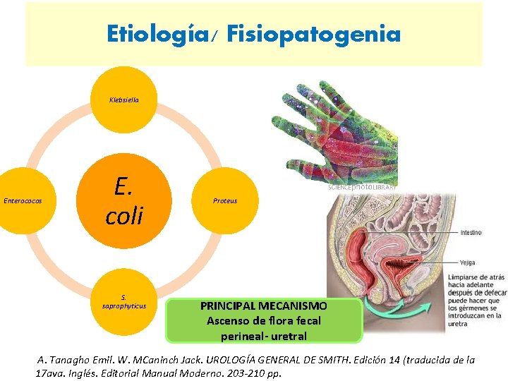 Etiología/ Fisiopatogenia Klebsiella Enterococos E. coli S. saprophyticus Proteus PRINCIPAL MECANISMO Ascenso de flora