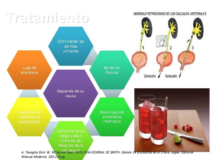 Tratamiento Eliminación qx de litos urinarios Jugo de arandano Qx de las fistulas Depende