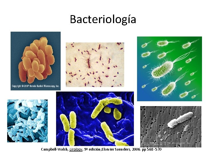 Bacteriología Campbell-Walsh, Urology, 9ª edición, Elsevier Saunders, 2006. pp 568 -570 