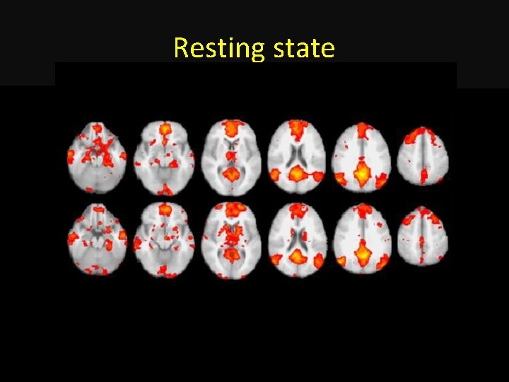 Resting state 