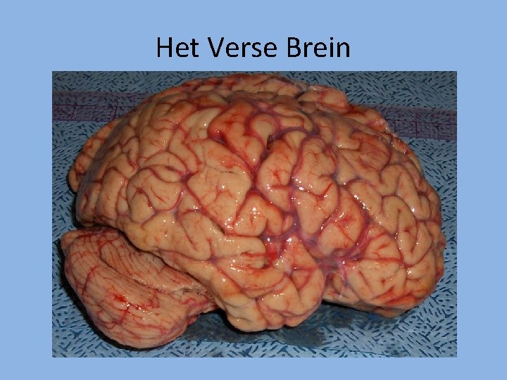 Het Verse Brein 