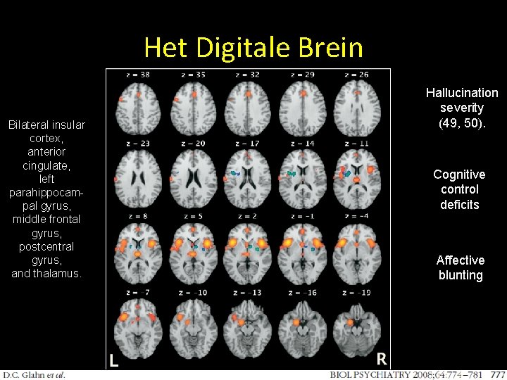 Het Digitale Brein Bilateral insular cortex, anterior cingulate, left parahippocampal gyrus, middle frontal gyrus,