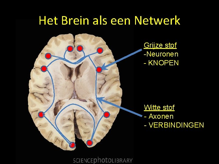 Het Brein als een Netwerk Grijze stof -Neuronen - KNOPEN Witte stof - Axonen