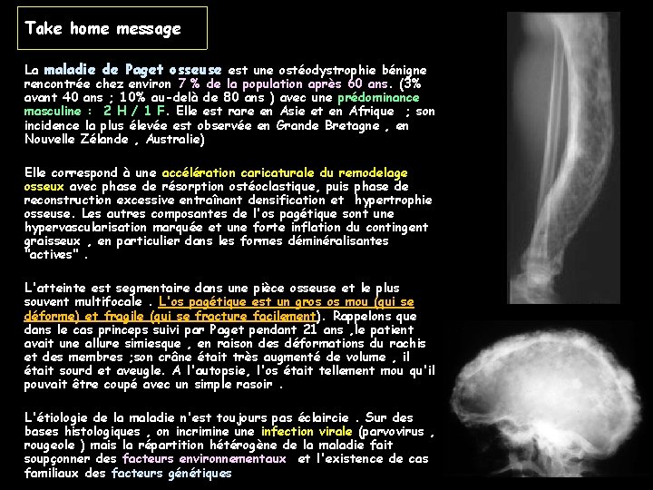 Take home message La maladie de Paget osseuse est une ostéodystrophie bénigne rencontrée chez