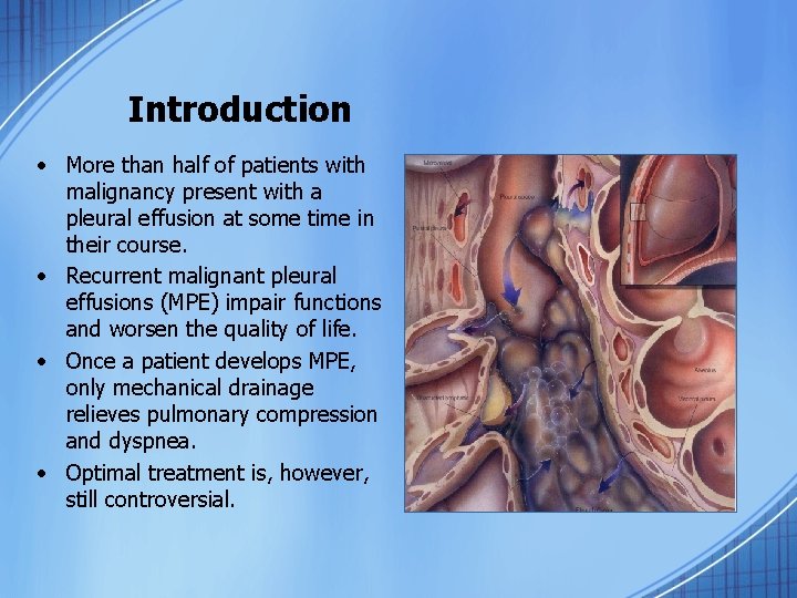 Introduction • More than half of patients with malignancy present with a pleural effusion
