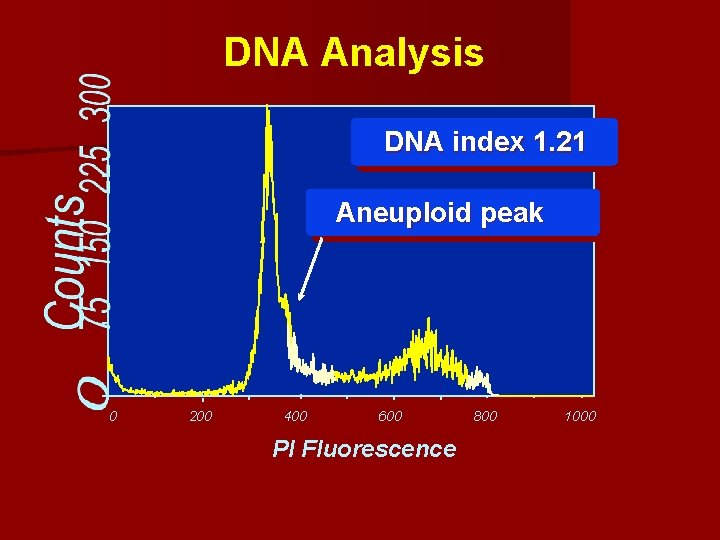 DNA Analysis DNA index 1. 21 Aneuploid peak 0 200 400 600 PI Fluorescence