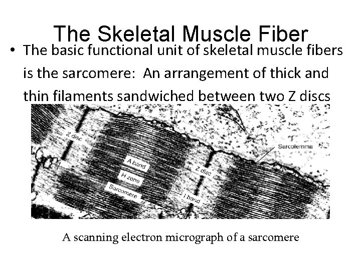 The Skeletal Muscle Fiber • The basic functional unit of skeletal muscle fibers is