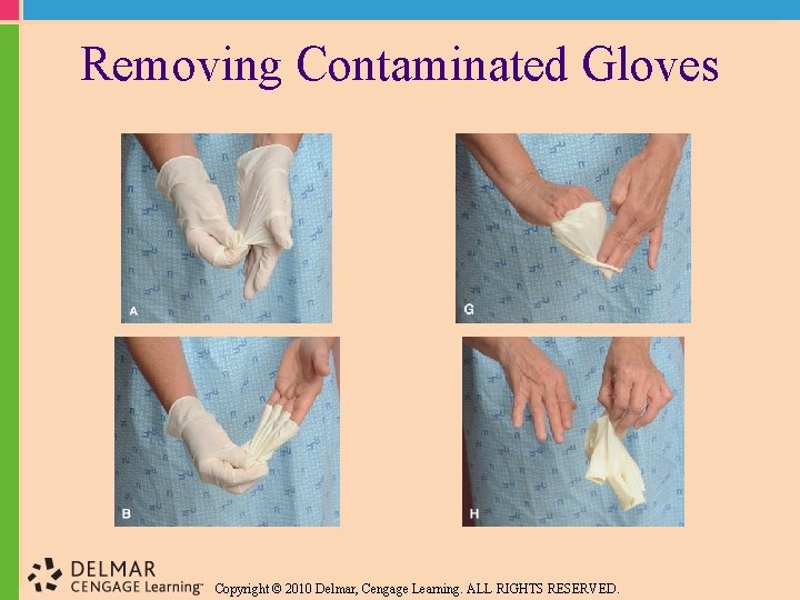 Removing Contaminated Gloves Copyright © 2010 Delmar, Cengage Learning. ALL RIGHTS RESERVED. 