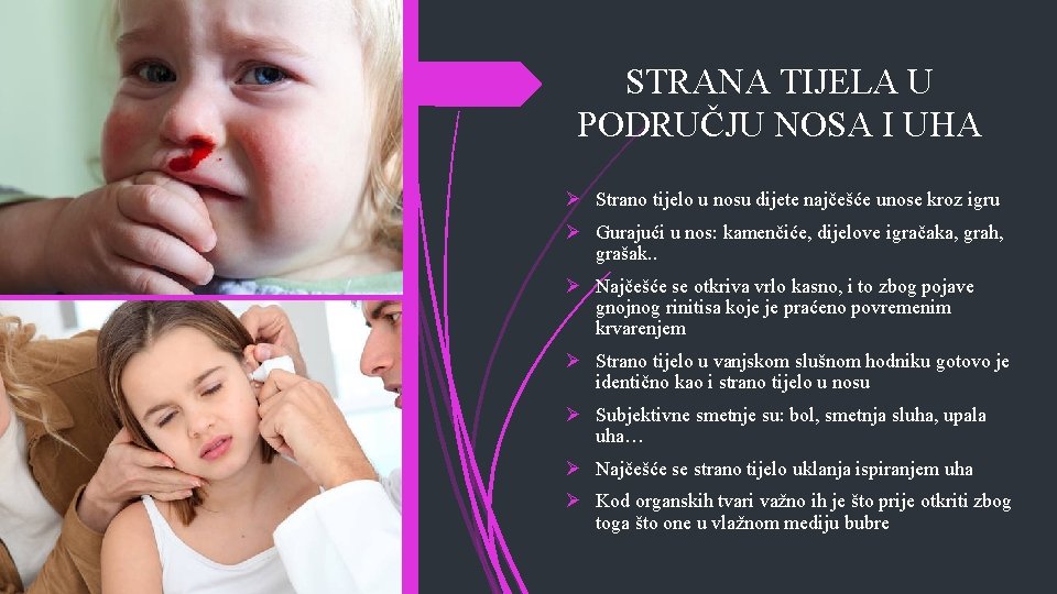 STRANA TIJELA U PODRUČJU NOSA I UHA Ø Strano tijelo u nosu dijete najčešće