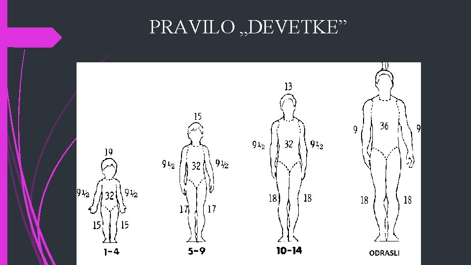 PRAVILO „DEVETKE” 