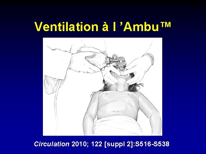 Ventilation à l ’Ambu™ Circulation 2010; 122 [suppl 2]: S 516 -S 538 