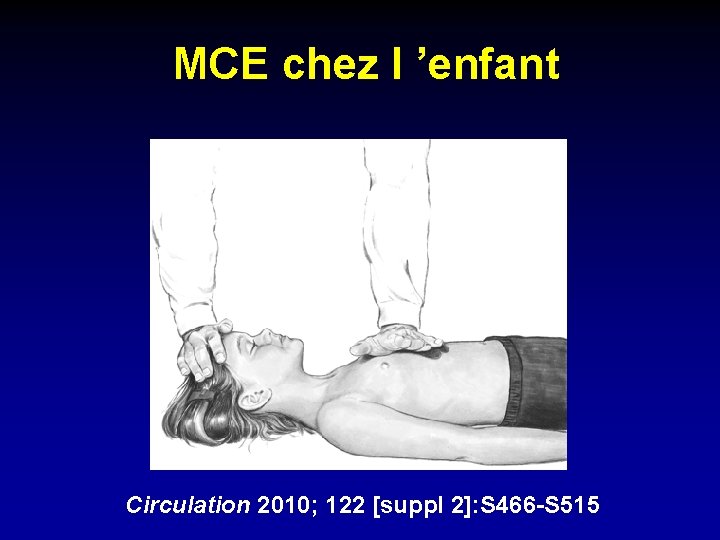 MCE chez l ’enfant Circulation 2010; 122 [suppl 2]: S 466 -S 515 