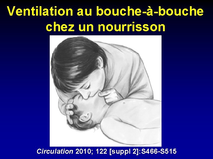 Ventilation au bouche-à-bouche chez un nourrisson Circulation 2010; 122 [suppl 2]: S 466 -S