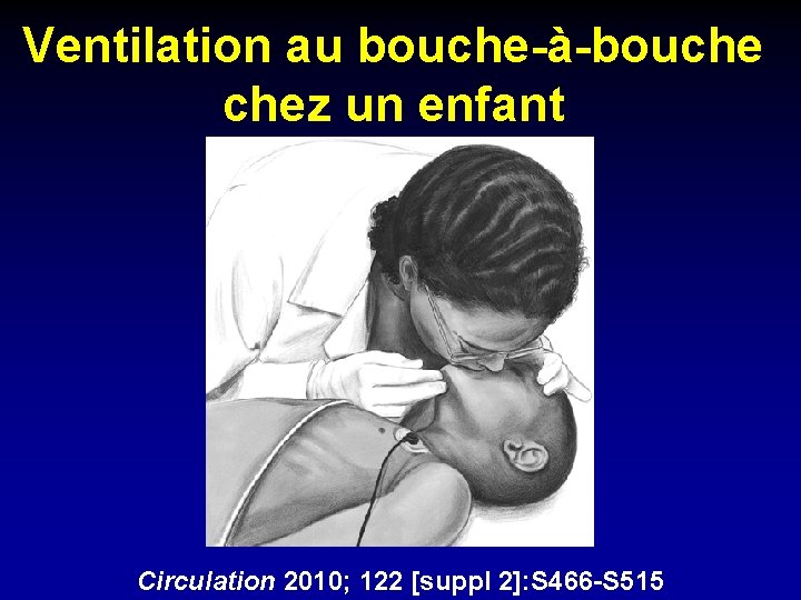 Ventilation au bouche-à-bouche chez un enfant Circulation 2010; 122 [suppl 2]: S 466 -S