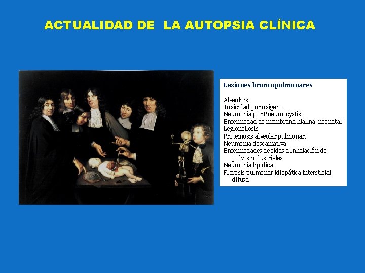 ACTUALIDAD DE LA AUTOPSIA CLÍNICA Lesiones broncopulmonares Alveolitis Toxicidad por oxígeno Neumonía por Pneumocystis