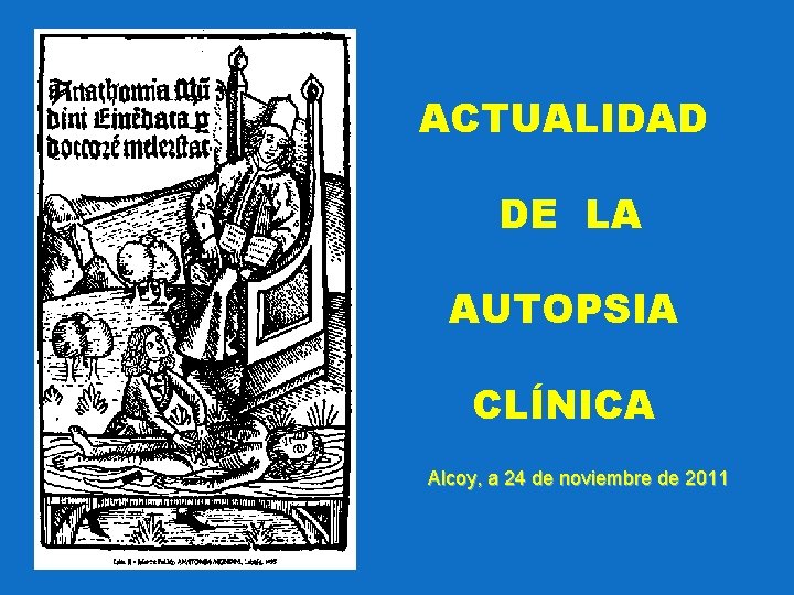 ACTUALIDAD DE LA AUTOPSIA CLÍNICA Alcoy, a 24 de noviembre de 2011 
