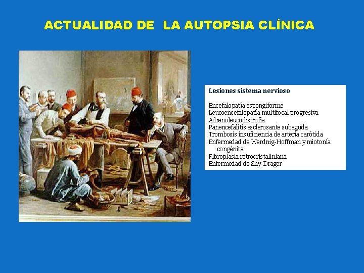 ACTUALIDAD DE LA AUTOPSIA CLÍNICA Lesiones sistema nervioso Encefalopatía espongiforme Leucoencefalopatía multifocal progresiva Adrenoleucodistrofia