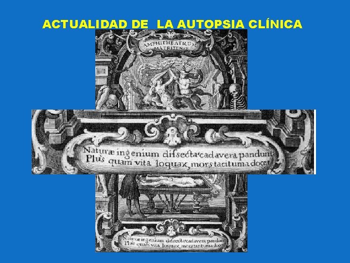 ACTUALIDAD DE LA AUTOPSIA CLÍNICA 