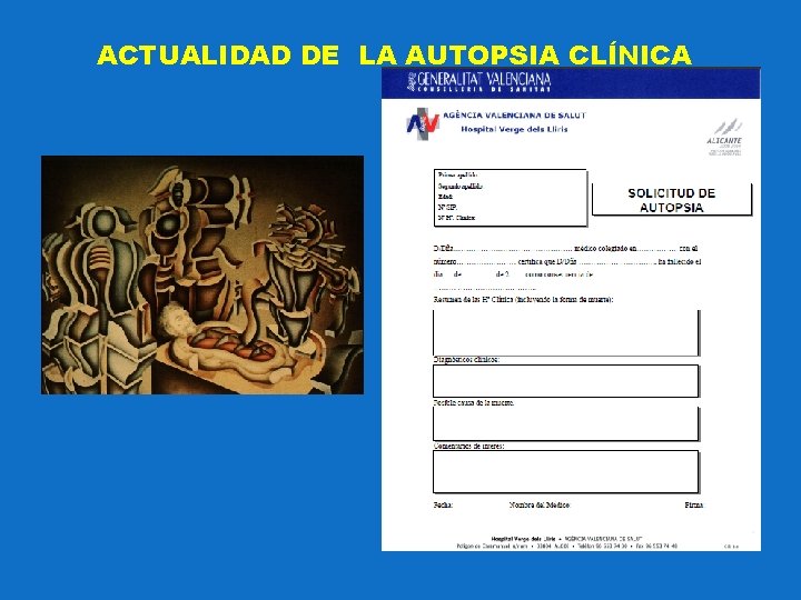 ACTUALIDAD DE LA AUTOPSIA CLÍNICA 