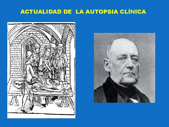 ACTUALIDAD DE LA AUTOPSIA CLÍNICA 